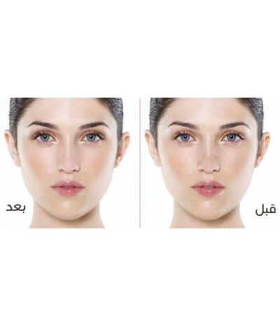 ⁦لصقات الانف من كيلان⁩ - الصورة ⁦2⁩